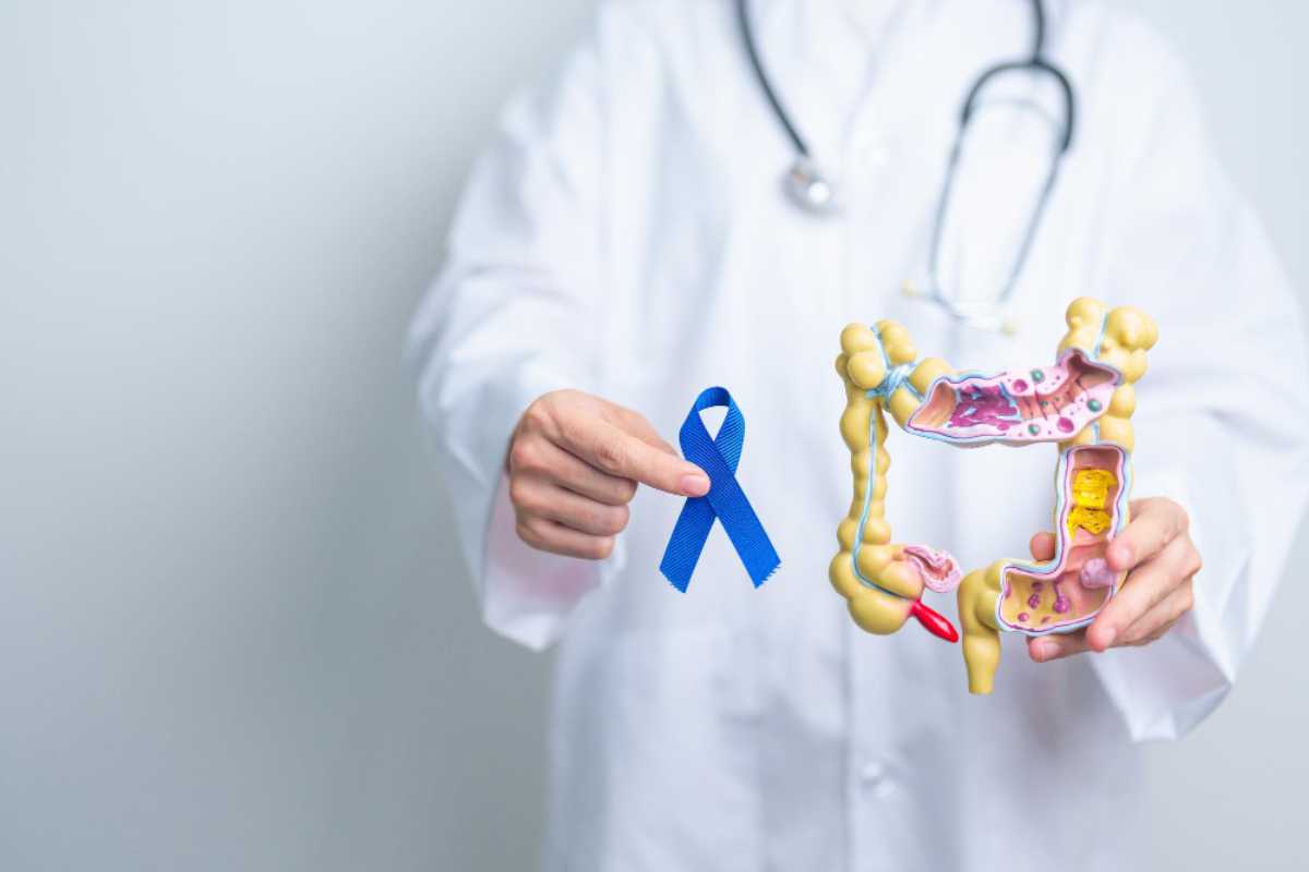 Aumento de casos de câncer colorretal entre jovens e como exames digestivos salvam vidas