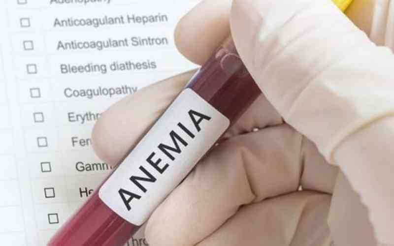 como-saber-tenho-anemia
