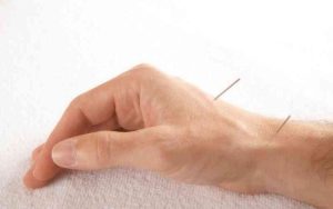 acupuntura-ajudar-aliviar-dor-artrite