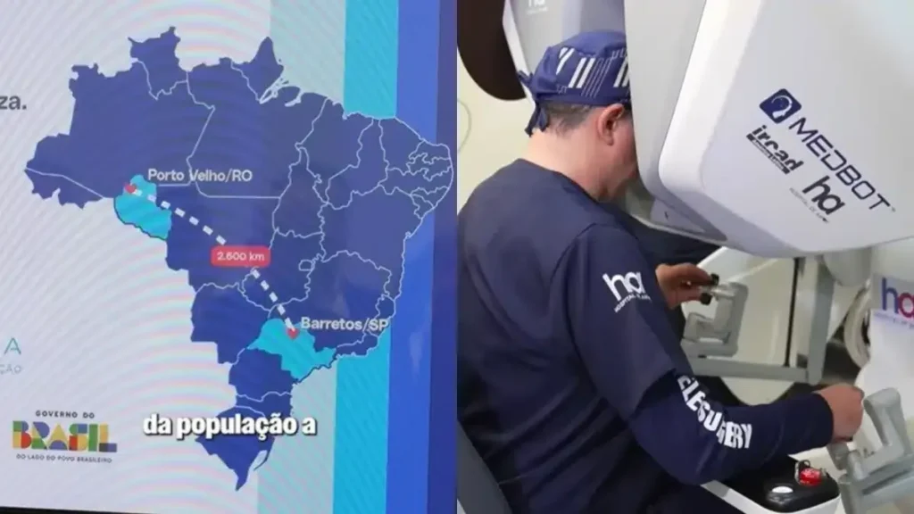 SUS faz 1ª telecirurgia robótica a 2.700 km de distância