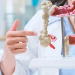 Intestino saudável em 30 dias? Médica revela hábitos essenciais