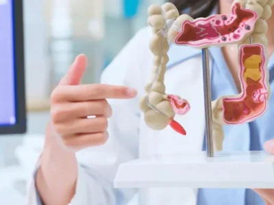 Intestino saudável em 30 dias? Médica revela hábitos essenciais