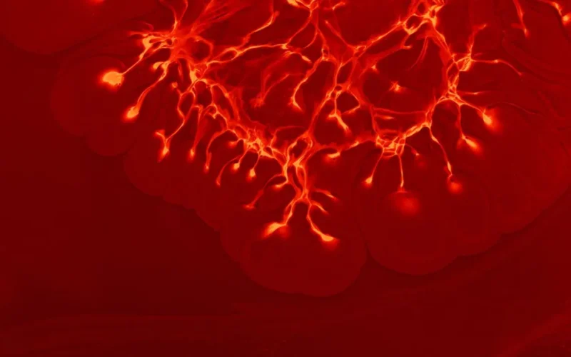 Visão embaçada pode ser sinal de aneurisma cerebral